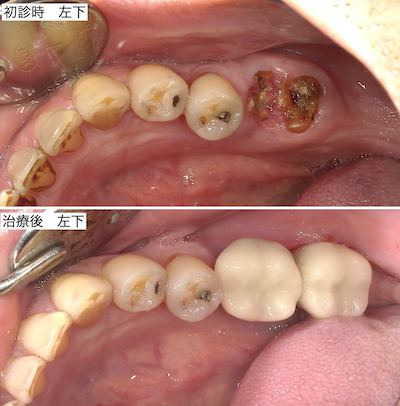 治療後