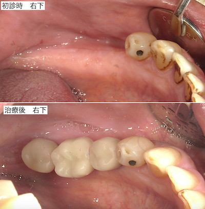 治療後
