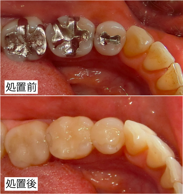 処置前後