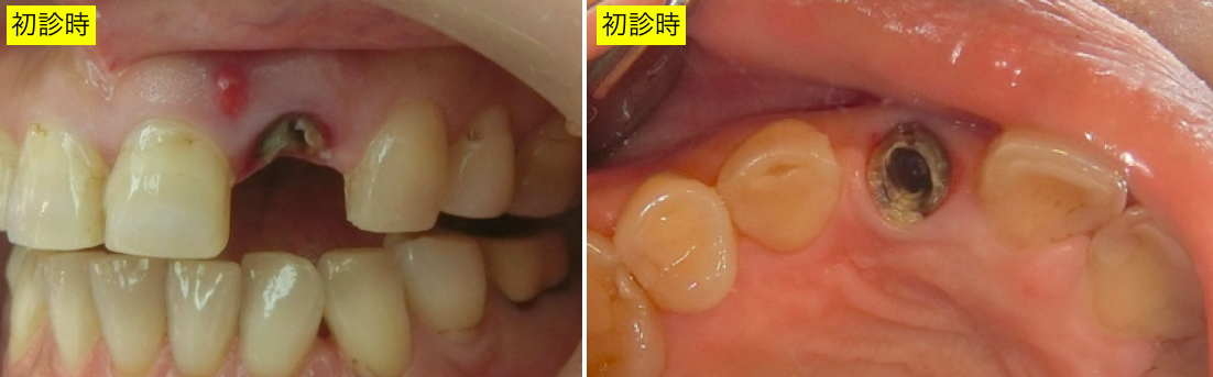 初診時２