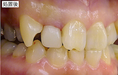 治療後