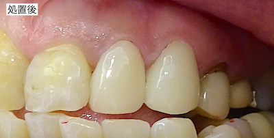 治療後