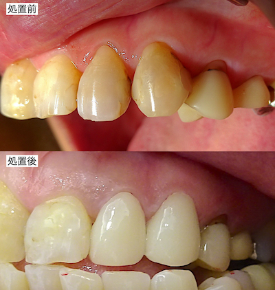 治療前後