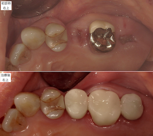 治療前後