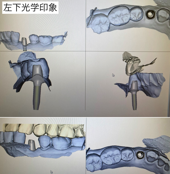 光学印象