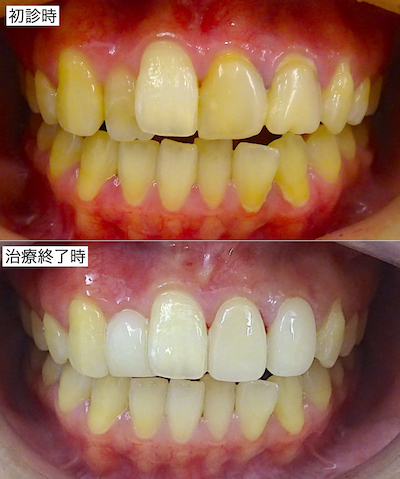 治療前後