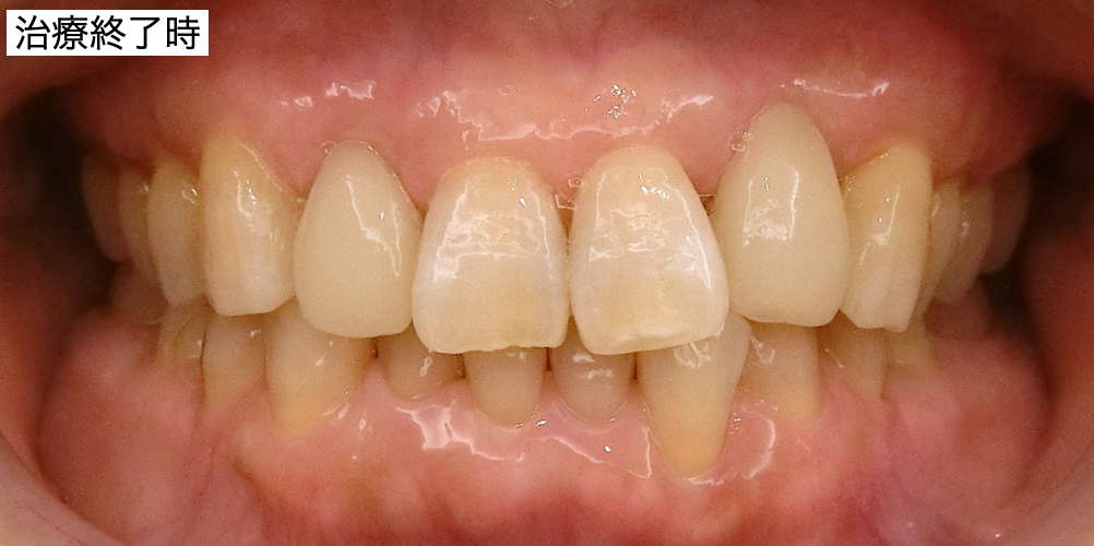 治療後