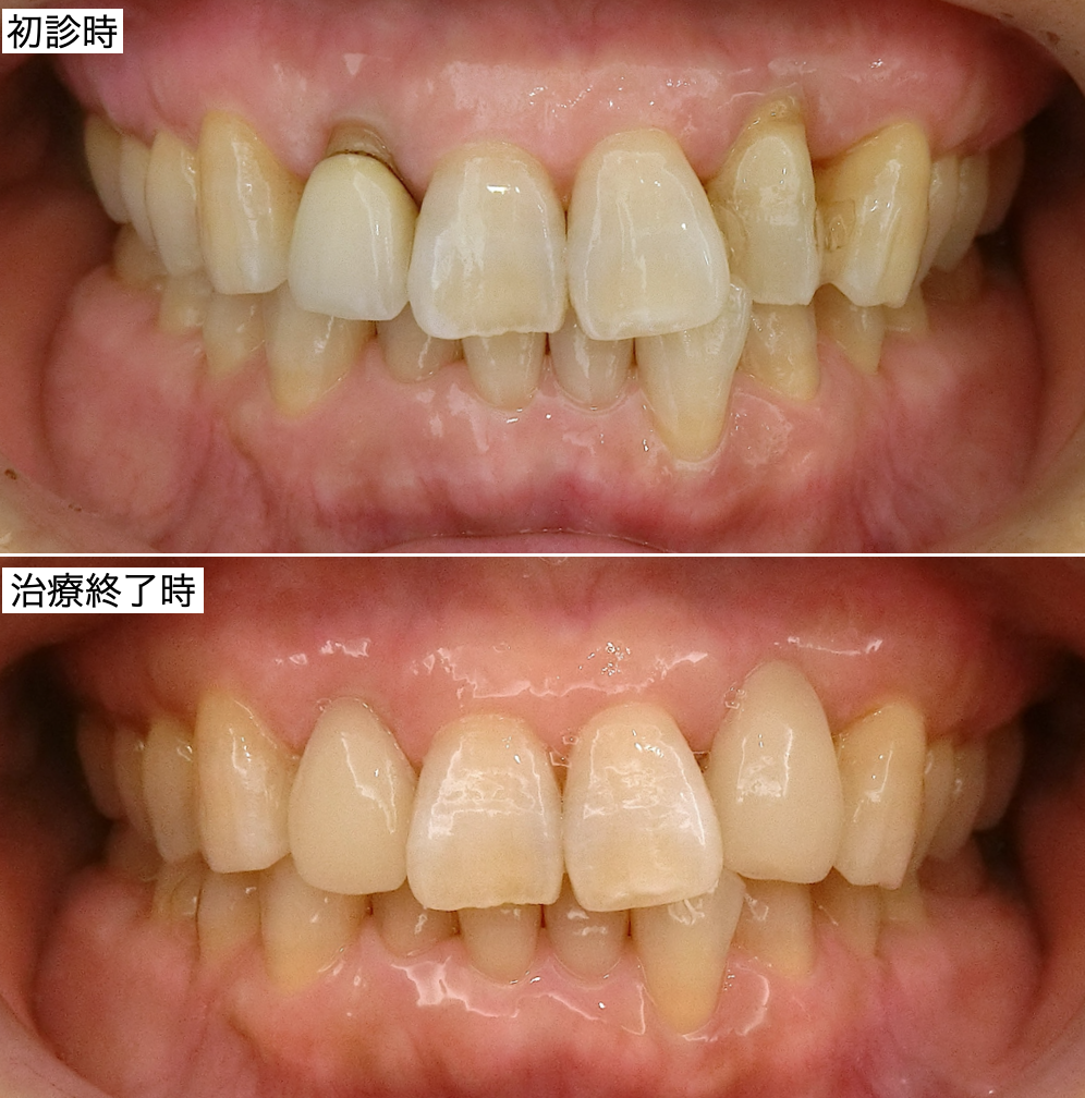 治療前後