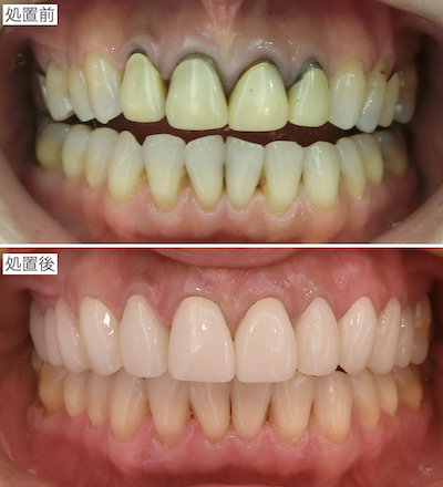 治療前後