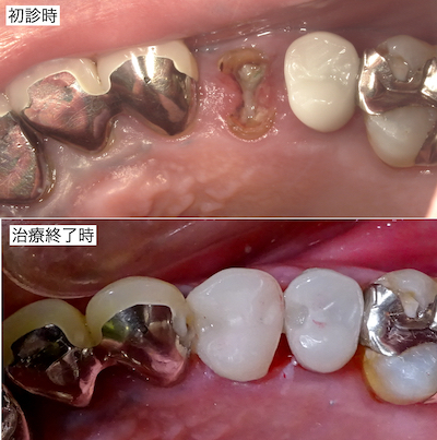 治療前後
