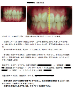 s李治療計画