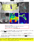 手術計画書