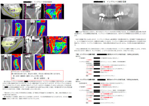 治療計画