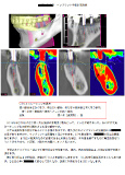 手術計画書