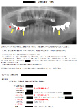 治療計画書