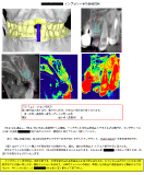 手術計画