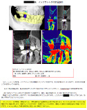 手術計画書