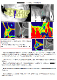 手術計画書