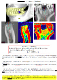 手術計画書