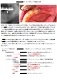 治療計画書