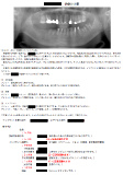 治療計画書
