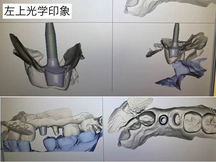 光学印象