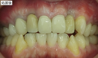 処置後